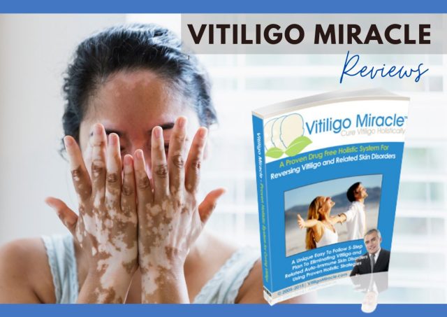 vitiligo miracle reviews