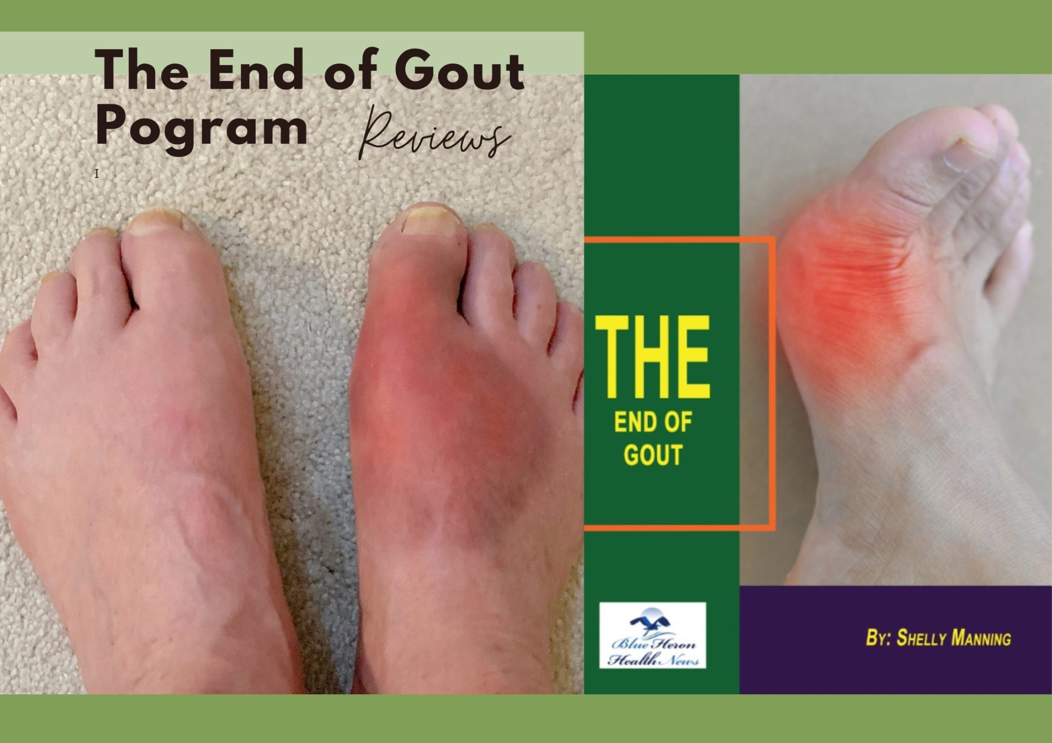 The End Of Gout Pogram 2048x1448 