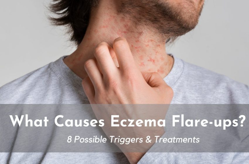 What Causes Eczema Flareups? 8 Possible Triggers • Dumblittleman